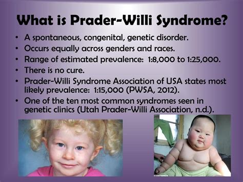 Prader-Willi szindróma genetikai okai