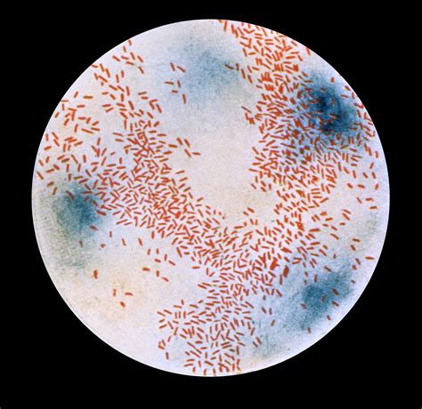 A Haemophilus influenzae b baktérium mikroszkópos képe