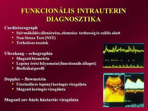 Magzati szívműködés görbéje NST vizsgálaton