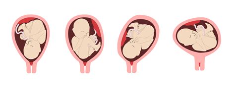 Magzat a méhben, magzatvízzel körülvéve