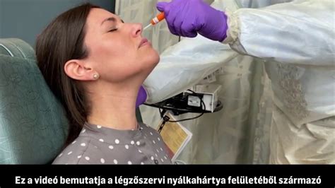 Laboratóriumi mintavétel folyamata