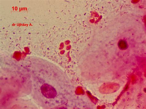 A csecsemőmirigy mikroszkópos képe