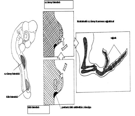 A pozícionális plagiocephalia és brachycephalia szemléltetése