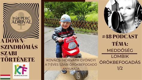 Egy orvos vizsgál Down-szindrómás gyermeket
