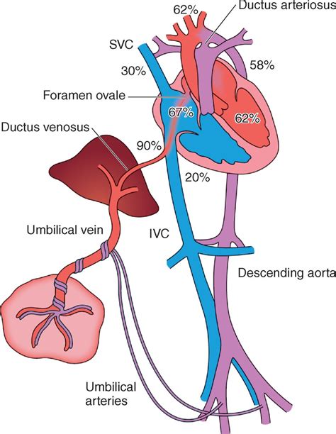 A magzati keringés főbb struktúrái: ductus venosus, foramen ovale, ductus arteriosus