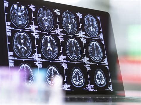 A magzati agy fejlődését ábrázoló MRI felvétel
