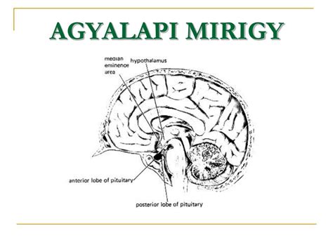 Agyalapi mirigy MRI
