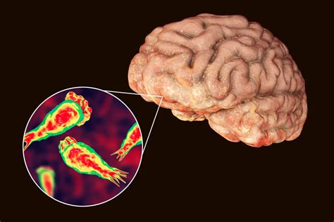 Az agyevő amőba (Naegleria fowleri) mikroszkópos képe