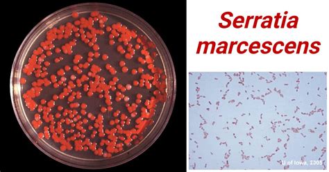 Serratia marcescens baktérium mikroszkopikus képe
