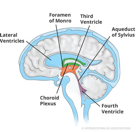 A choroid plexus és ciszta bemutatása