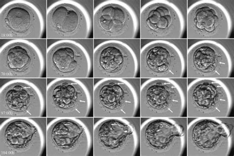 EmbryoScope a laboratóriumban