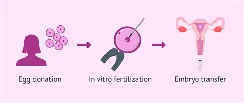 A donor petesejt IVF lépései