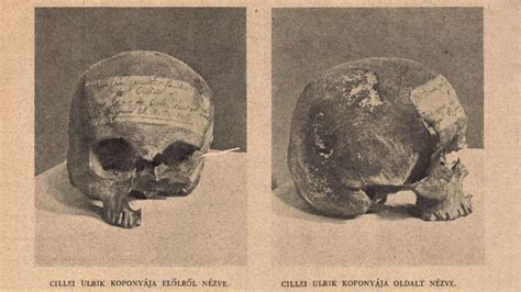 A baba koponyája a kutacsokkal és varratokkal