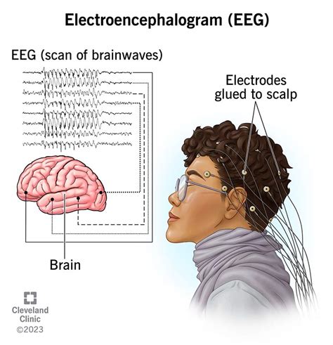 EEG elektródák felhelyezése