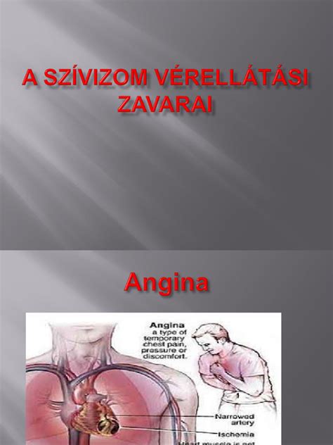 A szívbillentyűk működésének zavarai
