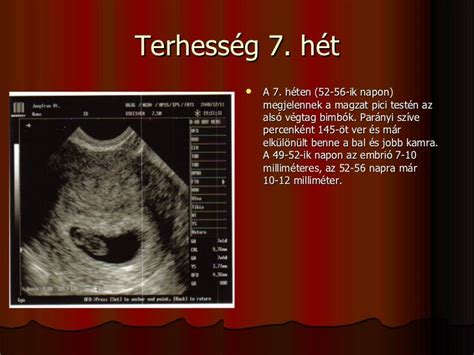 terhesség 21 hét ultrahang méretek