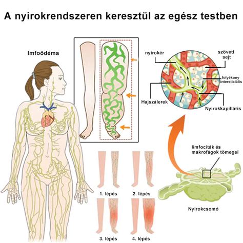 Infografika a kiégés tüneteiről és megelőzési módszereiről
