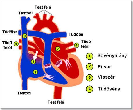 A szívbillentyű-betegségek diagnosztikai módszerei
