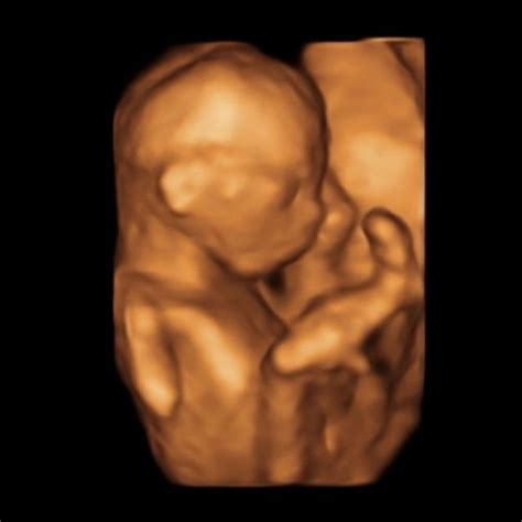 Várandós kismama ultrahang vizsgálaton