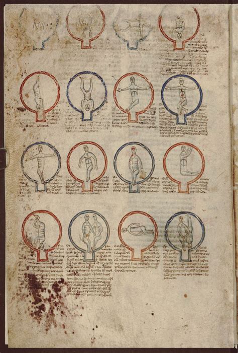 Magzatpozíciók. Albucasis Chirurgia című művében, 1280 körül