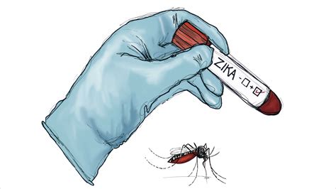 Zika vírus és mikrokefália