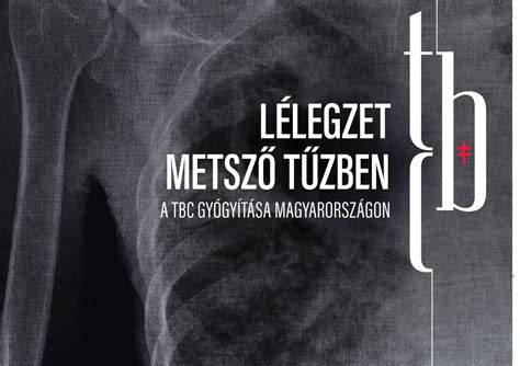 TBC diagnosztikai módszereket bemutató infografika