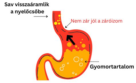 anatómia gyomor és nyelőcső záróizom
