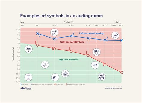 Audiogram minta