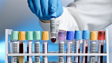 Laboratóriumi vizsgálatok