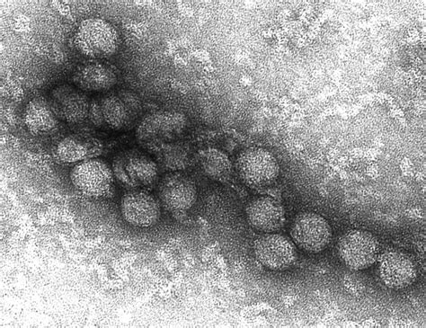 Influenza vírus elektronmikroszkópos képe