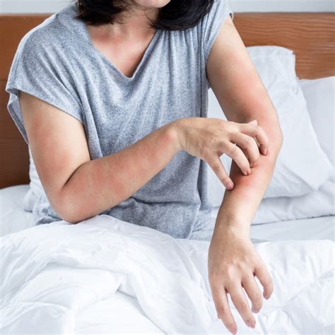 allergiatesztek