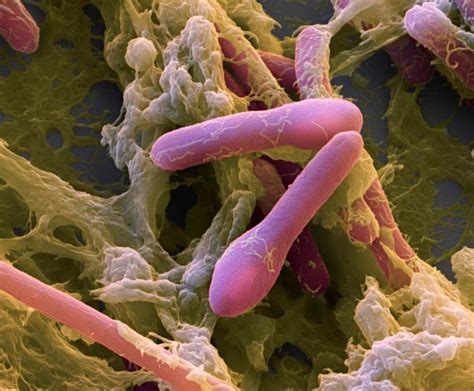 Clostridium botulinum baktérium elektronmikroszkópos képe
