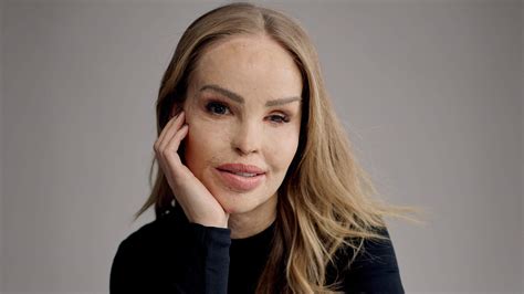 Katie Piper portréja