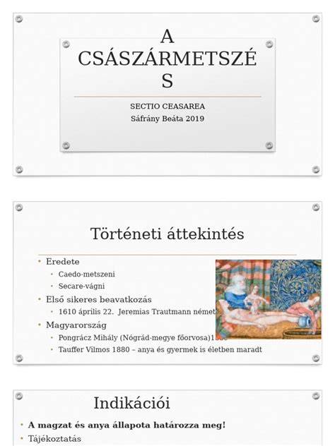 Császármetszés története infografika