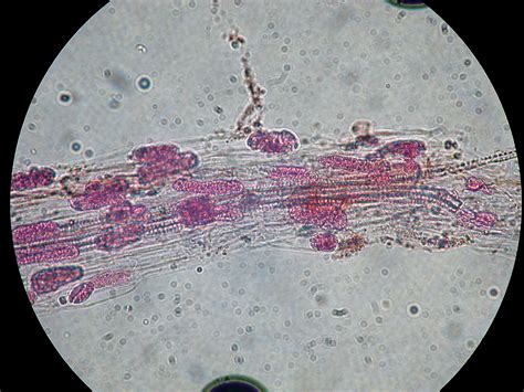 Penészgomba spórák mikroszkóp alatt