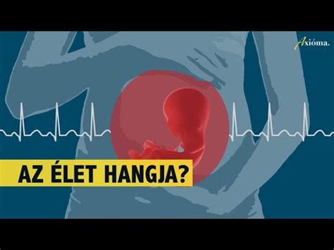 A szívhang-rendelet bevezetése Magyarországon