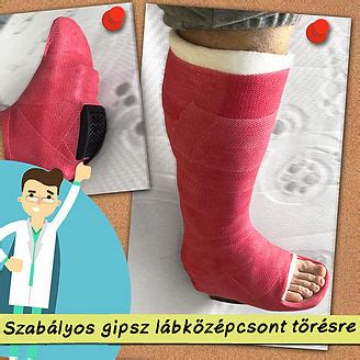 Különbség a törés és zúzódás között