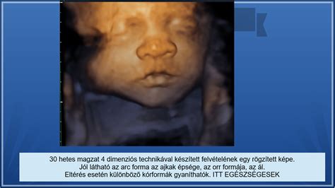 Térkép a Csodabent 3D/4D Magzati Ultrahang Stúdió megközelítéséhez