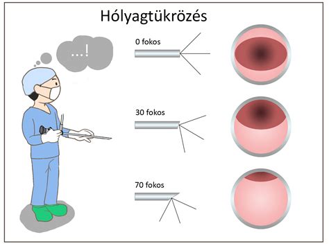 Tünetek és diagnózis a tőgygyulladásnál