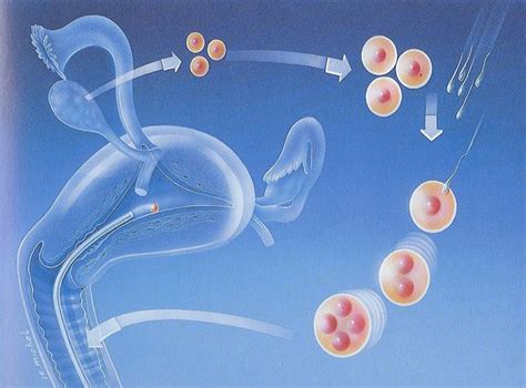 Az in vitro fertilizáció (IVF) lépései
