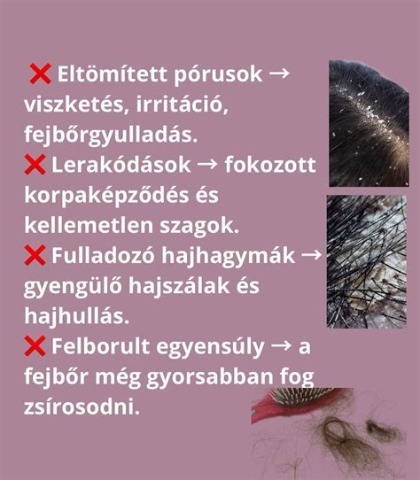 A bőrön jelentkező viszketés és irritáció csillapítása