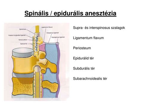 Epidurális anesztézia és szoptatás