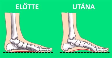 Ortopédusok által javasolt babapozíció hordozóban