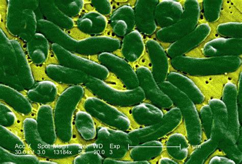 Streptococcus baktériumok mikroszkóp alatt