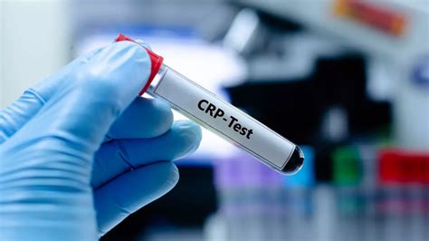 A CRP érték változása gyulladás esetén
