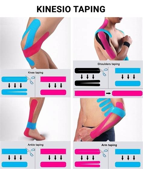 Kinesio-tape alkalmazása a háton